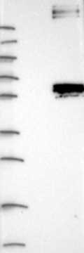 NBP1-90294 - NCEH1 / AADACL1
